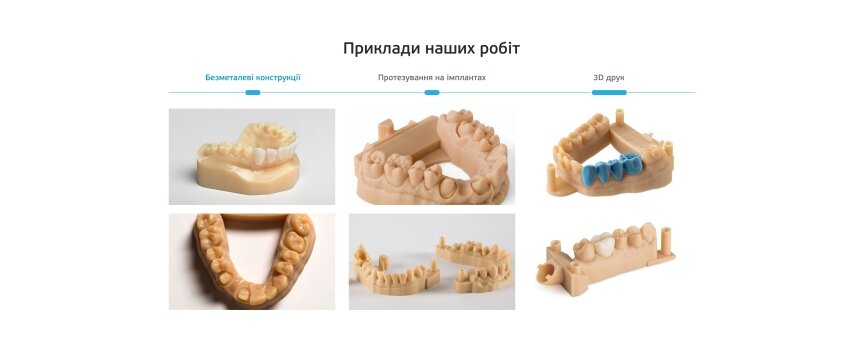 дизайн внутрішніх сторінкок на тему Медична тематика — Односторінковий сайт для зуботехнічної лабораторії АlphaDent 2